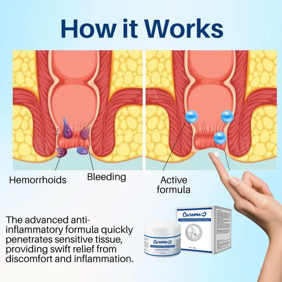 Maximum Strength Hemorrhoid & Fissure Treatment Cream