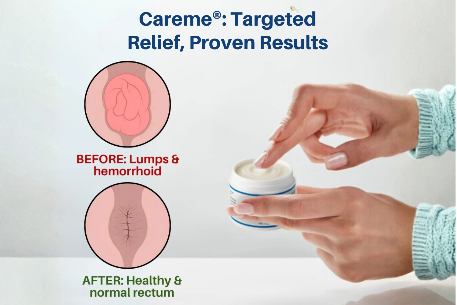 Maximum Strength Hemorrhoid & Fissure Treatment Cream